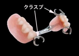 「部分床義歯」ってなに？～見えないところで大活躍のパーツたち～