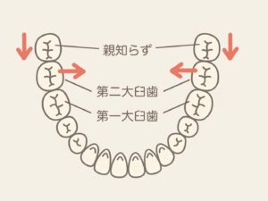 親知らずが原因で噛み合わせが悪くなる？隠れた歯並びの問題とは｜北戸田デンタルクリニック（戸田市）